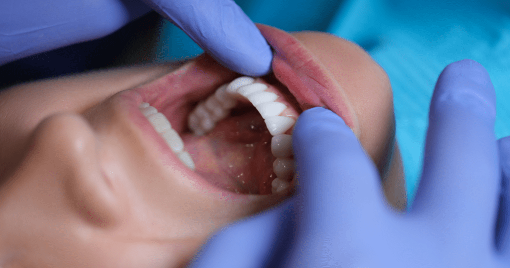 Oral Cancer Screenings